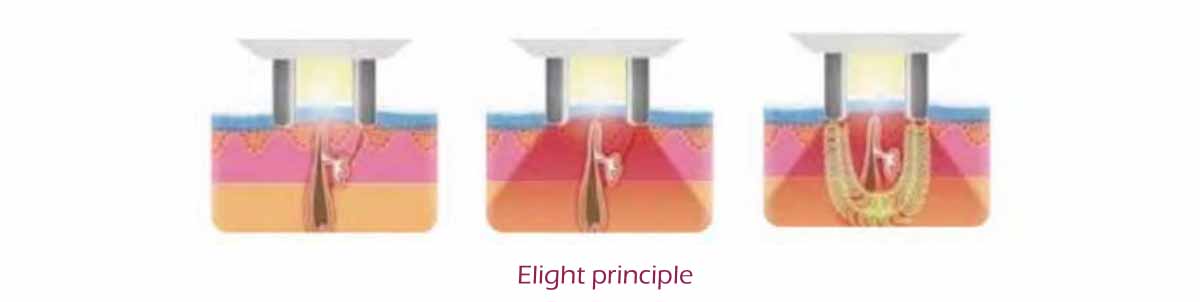 Elight principle