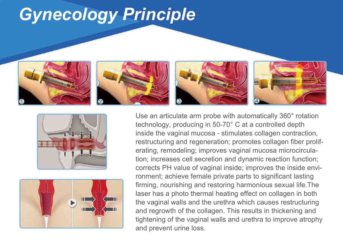 Gynecology Principle